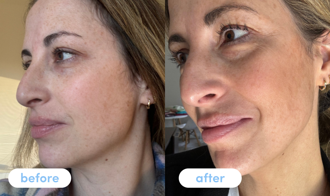 Ellyn S. - Taking Premium Collagen Peptides for 4 weeks