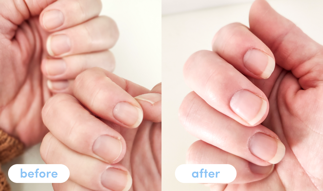 blog-1-1 Haylee T. - Taking Premium Collagen Peptides for 4 weeks – The Collagen Co NZ